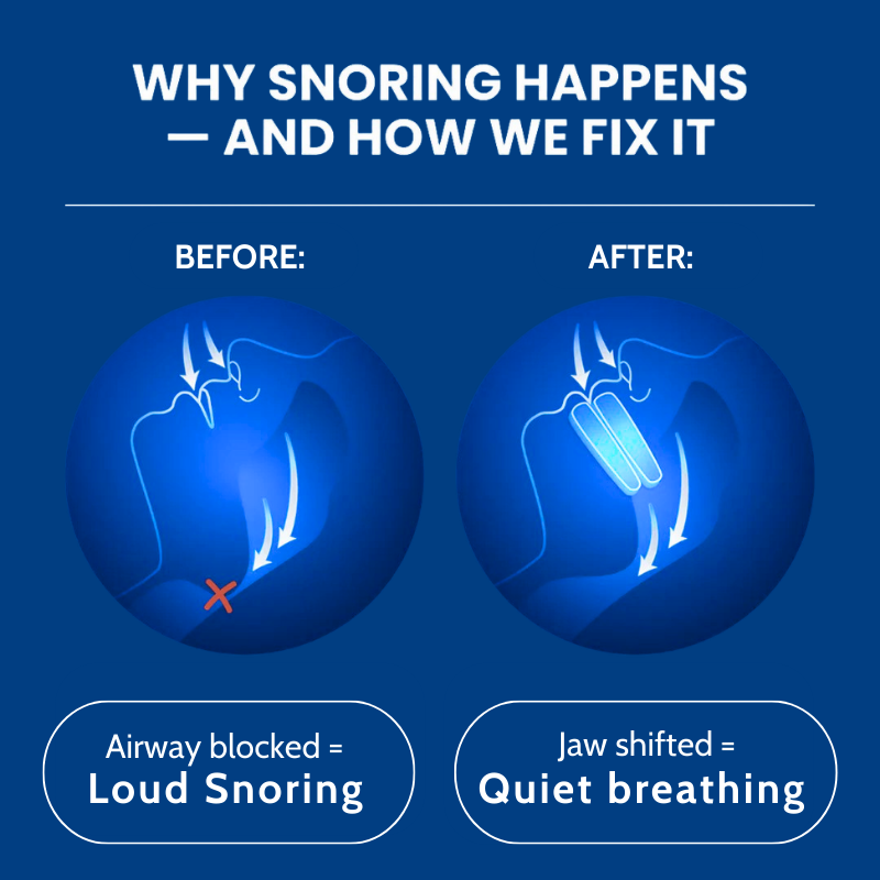 QuietTrial Plus® Anti-Snoring Mouthpiece